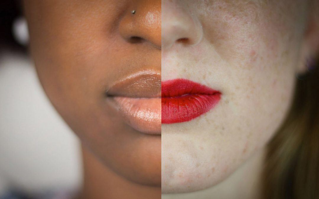 Creativity Demands Diversity